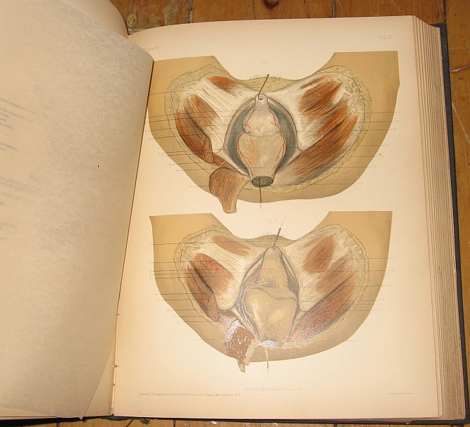 Image for Regional Anatomy in Its Relation to Medicine and Surgery. Vol. II. Third Edition